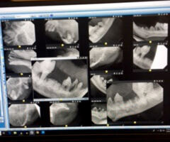 Dental-Xrays-of-Edgar